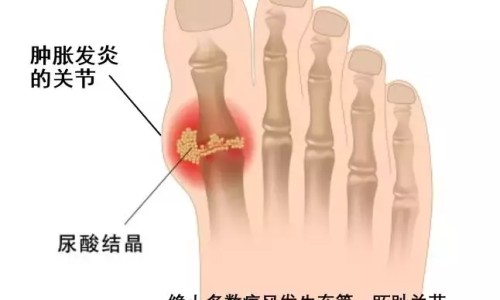 心脏病人应注意啥-心脏病人平时在饮食方面应注意什么-专业心脏病人应注意啥平台-心脏病饮食注意事项及禁忌